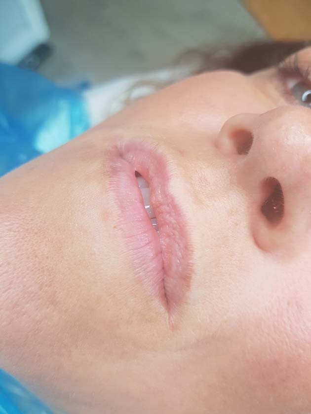 Before Lip Blush - Lip Liner - NKL Permanent Makeup Hampshire