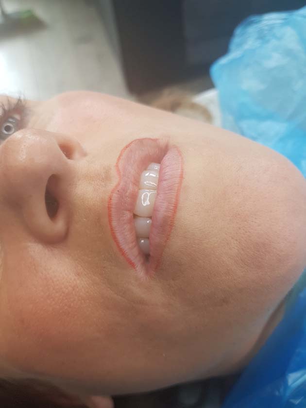 Lip Liner - NKL Permanent Makeup Hampshire