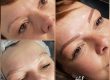 Microblading